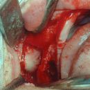 Sinus 1