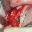 Sinus 2