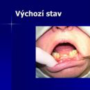 Výchozí stav