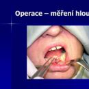 Operace- měření hloubky