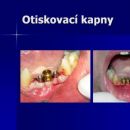 Otiskovací kapny