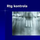 RTG kontrola