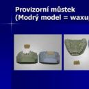 Provizorní můstek